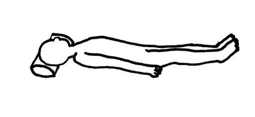 背臥位のイラスト図