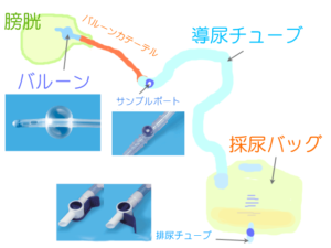 人体図 イラスト カルテ記録や問診票用など フリー素材 介護看護リハビリのフリー素材集
