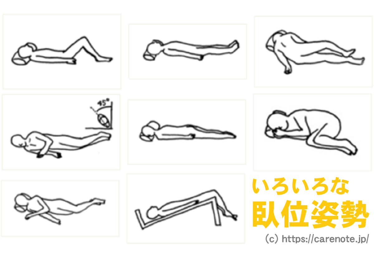 臥位姿勢の種類　７種類の体位の名前と特徴をイラスト解説