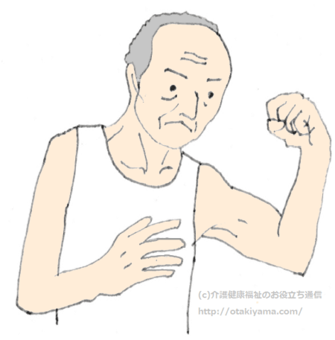 老年症候群とは　拘縮・筋力低下・褥瘡、生活機能やQOLを低下