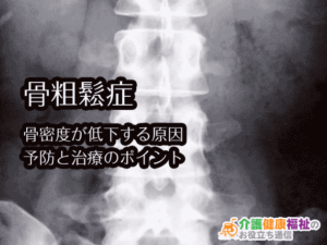 骨粗鬆症 骨密度が低下する原因を知り予防と治療を