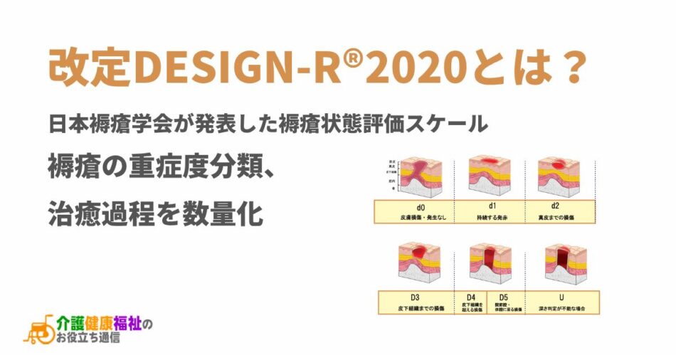 改定DESIGN-R®2020とは?褥瘡の重症度分類、治癒過程を数量化