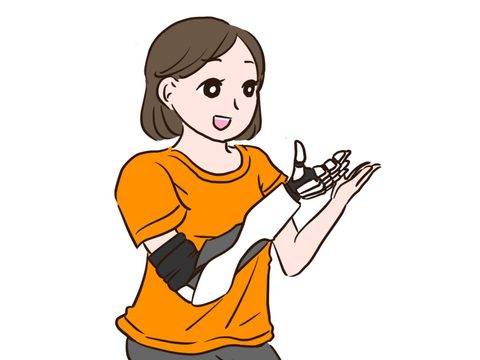義手を着用した女性