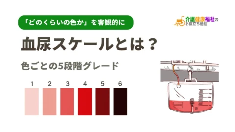 血尿スケールとは？色ごとの5段階グレード、介護で状態確認のポイント