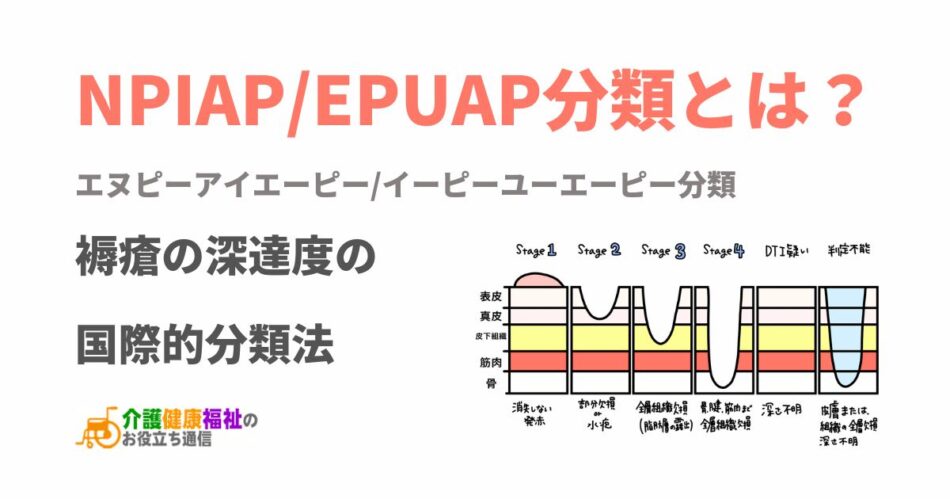 NPIAP/EPUAP分類とは?読み方・褥瘡の重症度分類と評価・対応